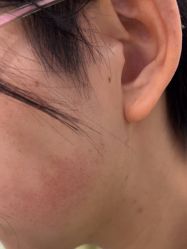-美瑞莎创美医疗美容