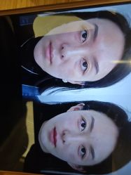 -Yestar杭州艺星医疗美容医院