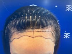 -雍禾植发全国连锁