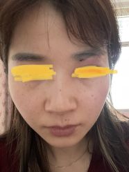 -大华韩艺整形美容医院