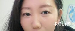 体验后-天津伊美尔医疗整形美容专科医院