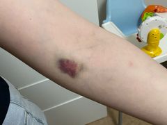 -深圳大学总医院