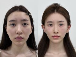 -Yestar重庆艺星医疗美容医院