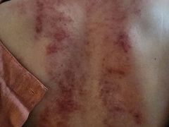 -天然沐足·推背采耳·敷姜艾灸(龙眼美食街店)