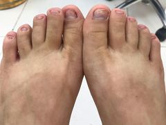 -新甲连锁灰指甲·甲沟炎·鸡眼(黑龙江路店)