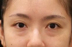 体验前-南京康美美容医院·旗舰店