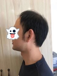 点击看大图 -极客侠男士假发定制补发