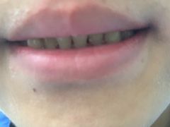 -极光口腔·矫正种植修复(锦江院区)