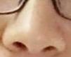 -成都苗方清颜专业祛痘