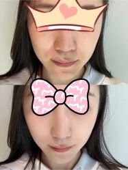 体验后-杭州米兰柏羽医疗美容医院