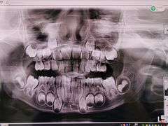 -同步齿科·数字化正畸种植口腔中心(珠海店)