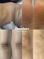 点击看大图 -Deeplus+韩国皮肤管理한국피부관리·C:Lab肌肤实验室
