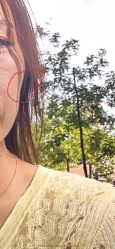 -铂特丽医美·眼鼻整形·光电美肤·注射抗衰