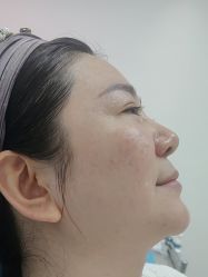 -长沙雅美医疗美容医院