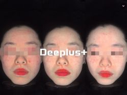 -Deeplus+韩国皮肤管理한국피부관리·C:Lab肌肤实验室