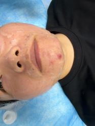 -长沙雅美医疗美容医院