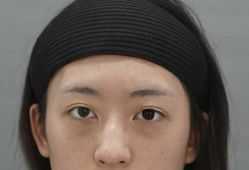 -天津健丽·去眼袋医疗美容机构