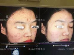点击看大图 -苑苑vbeauty科技美容SPA