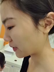 -长沙雅美医疗美容医院