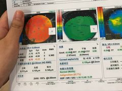 -苏州大学理想眼科医院