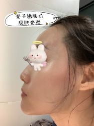 体验后-厦门美莱整形美容医院