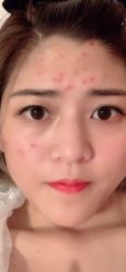 -VE专注问题肌·赛诺龙&科学美肤中心