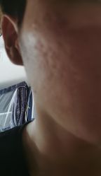 -丽美妍医疗美容·皮秒·立体分层抗衰