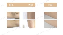 -HEYAN荷妍专业脱毛连锁机构