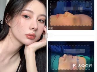 针眼就不太明显了 鼻子上还有个小点点