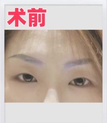 -素美医疗美容·西南眼鼻整形·修复基地