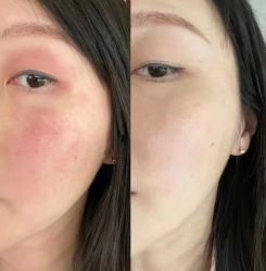 -苑苑vbeauty科技美容SPA