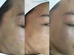 -SKIN79皮肤管理中心