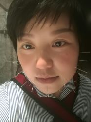 -肥三针腧穴瘦身馆