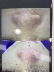 -蕾特恩专业祛痘·皮肤管理