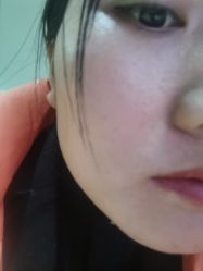 体验后-重庆军美医疗美容医院