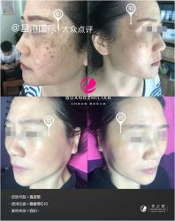 -星港国际·Skin皮肤专研·皮肤管理