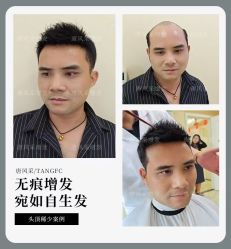 -唐风采假发补发定制
