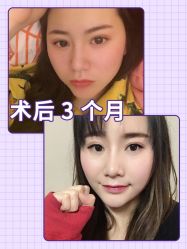-广东韩妃整形外科医院