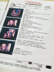 -艾博尔医院