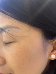 -长沙雅美医疗美容医院
