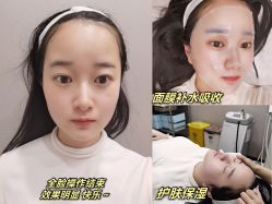 体验后-Yestar艺星医疗美容医院