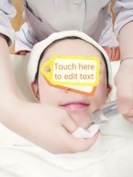 -苗方清颜专业祛痘连锁机构