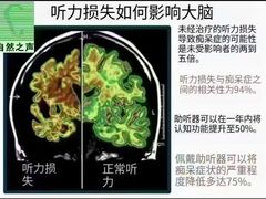 -自然之声助听器·呼吸机(康桥旗舰店)