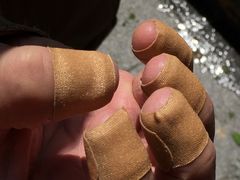 -德哥灰指甲甲沟炎跖疣脚气修复(仙霞西路店)