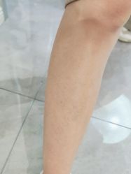 -咪咪专业脱毛连锁机构
