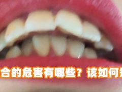 -团圆口腔·种植中心(锦江院区)