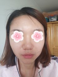 -苗方清颜•痘肌问题肌专研
