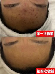 -YESIDO椰岛美容
