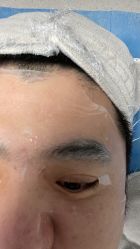 体验前-禾美嘉医疗美容