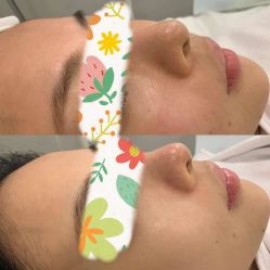 点击看大图 -EC BEAUTY易思美容